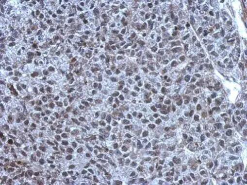 TET1 Antibody
