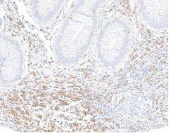 CD3 zeta Antibody (BL-336-1B2)