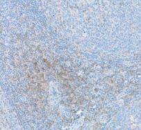 CD4 Antibody (BL-155-1C11)