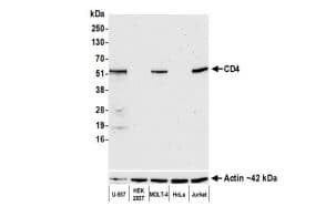CD4 Antibody (BL-155-1C11)