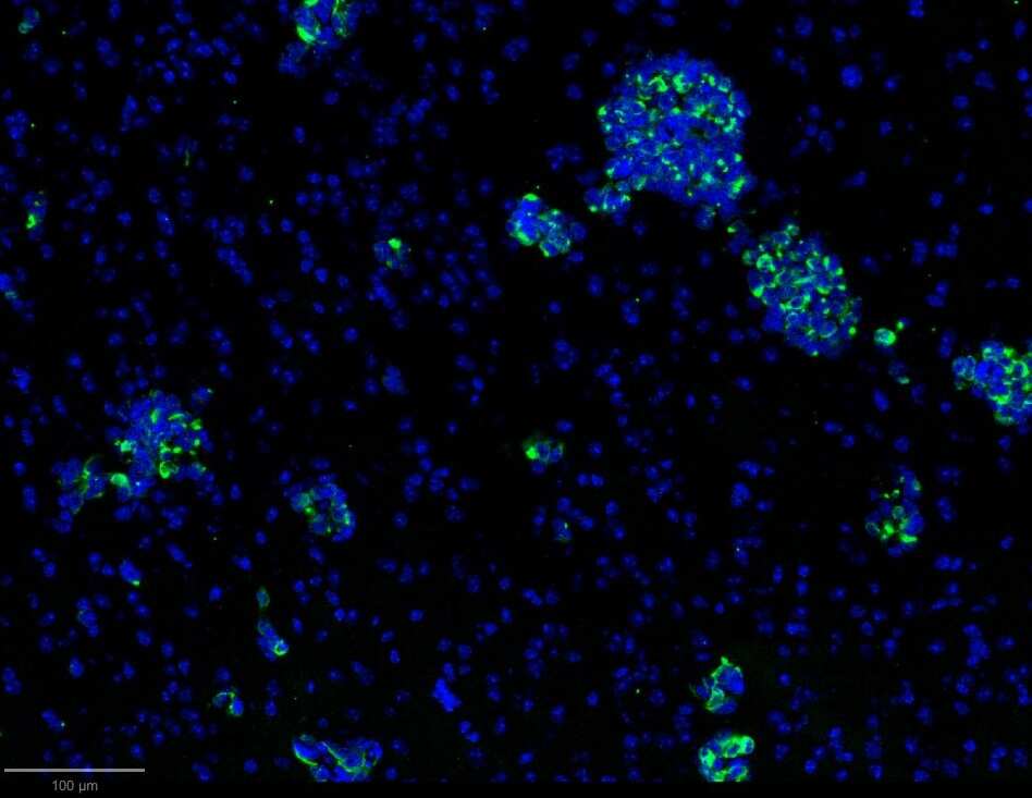 Cytokeratin, pan Antibody (PAN-CK (Cocktail)) [Alexa Fluor® 488]