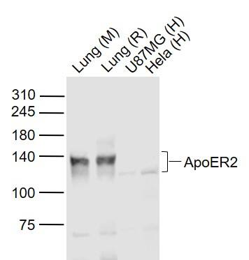Apolipoprotein E R2/ApoE R2 Antibody Western Blot: Apolipoprotein E R2/ApoE R2 Antibody [NBP2-76911]