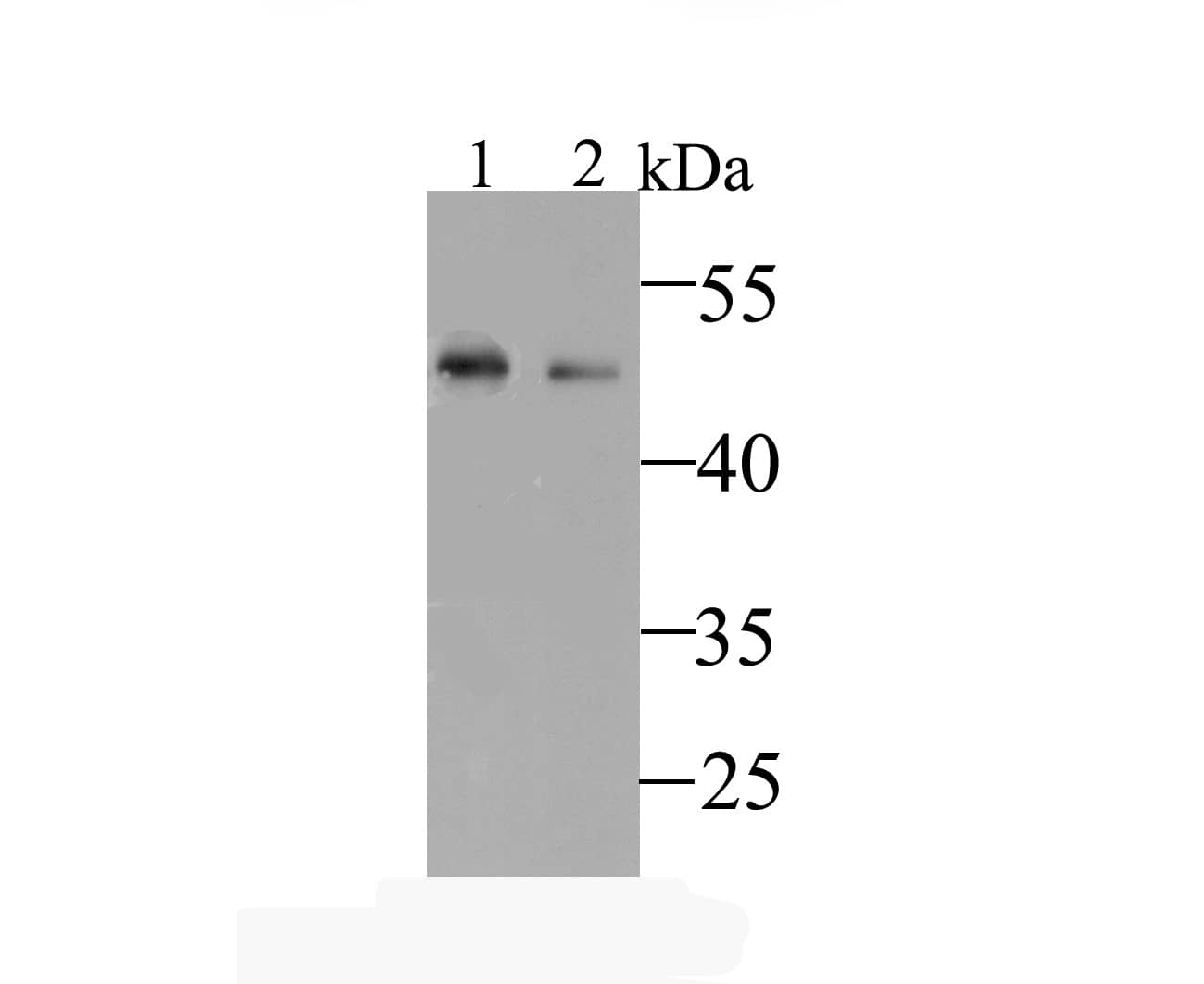 Kir6.2 Antibody Western Blot: Kir6.2 Antibody [NBP2-76944]