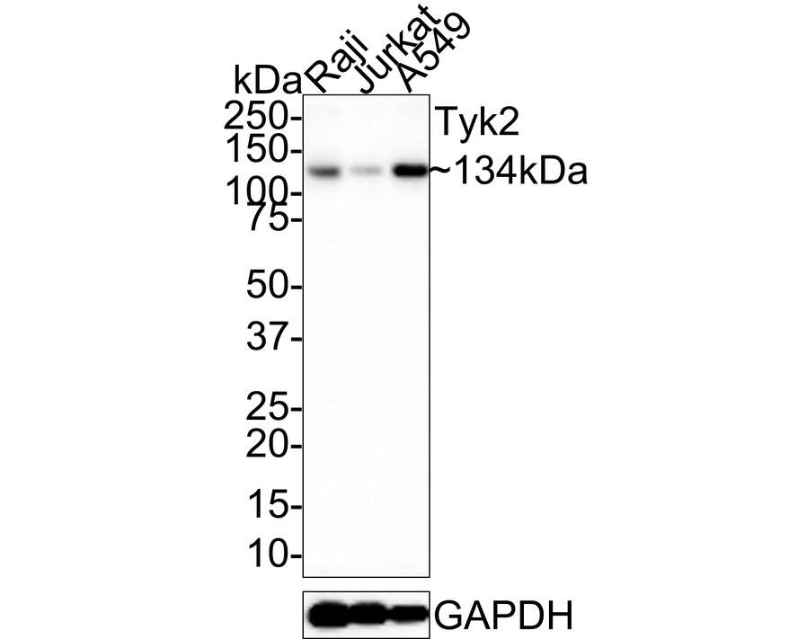 Tyk2 Antibody Western Blot: Tyk2 Antibody [NBP2-76968]