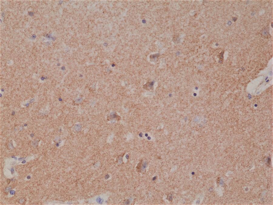 Spastin Antibody (RM346)