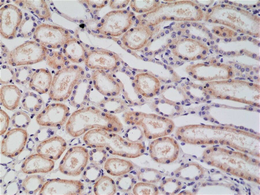 p120-catenin Antibody (RM353)
