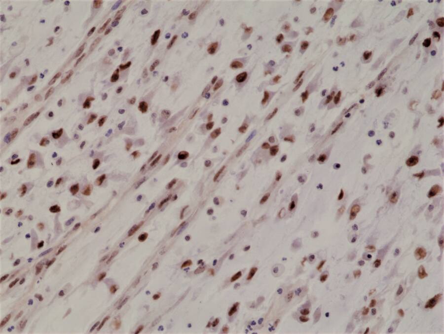 MyoD Antibody (RM369)