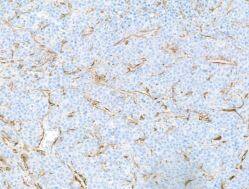 alpha-Smooth Muscle Actin Antibody (BLR082G)