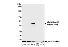 alpha-Smooth Muscle Actin Antibody (BLR082G)