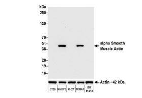alpha-Smooth Muscle Actin Antibody (BLR082G)