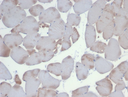 Alpha Actinin 2 Antibody (ACTN2/3293)