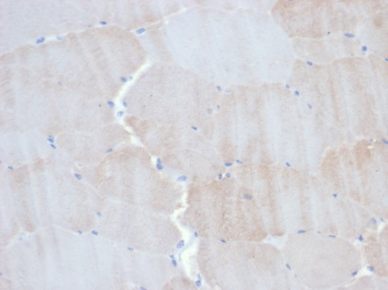 Alpha Actinin 2 Antibody (ACTN2/3293)
