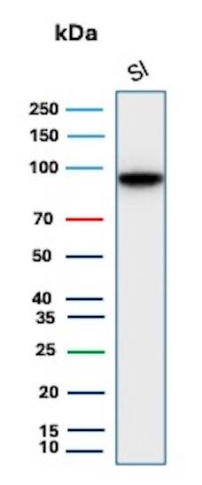 Cadherin-17 Antibody (CDH17/2618) Western Blot: Cadherin-17 Antibody (CDH17/2618) [NBP2-79723] -