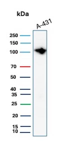 MCM6 Antibody (MCM6/2999) Western Blot: MCM6 Antibody (MCM6/2999) [NBP2-79727] -