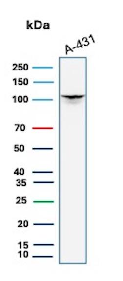 MCM6 Antibody (MCM6/3000) Western Blot: MCM6 Antibody (MCM6/3000) [NBP2-79728] -