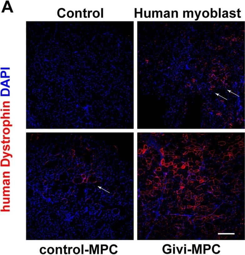 Dystrophin Antibody (DMD/3242)