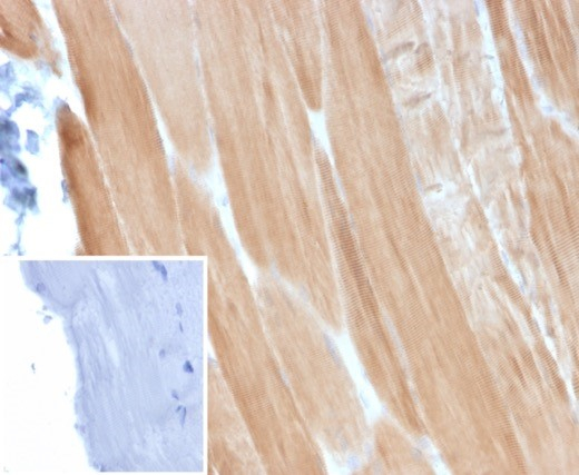 Alpha Actinin 2 Antibody (ACTN2/3293) - Azide and BSA Free