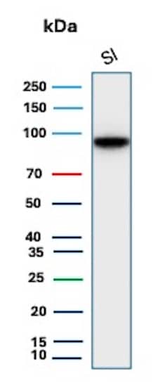Cadherin-17 Antibody (CDH17/2618) - BSA Free Western Blot: Cadherin-17 Antibody (CDH17/2618) - BSA Free [NBP2-79857] -