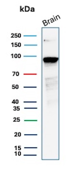 beta-Catenin Antibody (CTNNB1/2030R) - Azide and BSA Free Western Blot: beta-Catenin Antibody (CTNNB1/2030R) - Azide and BSA Free [NBP2-79888] -