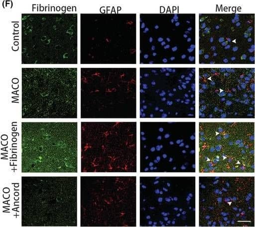 Fibrinogen Antibody