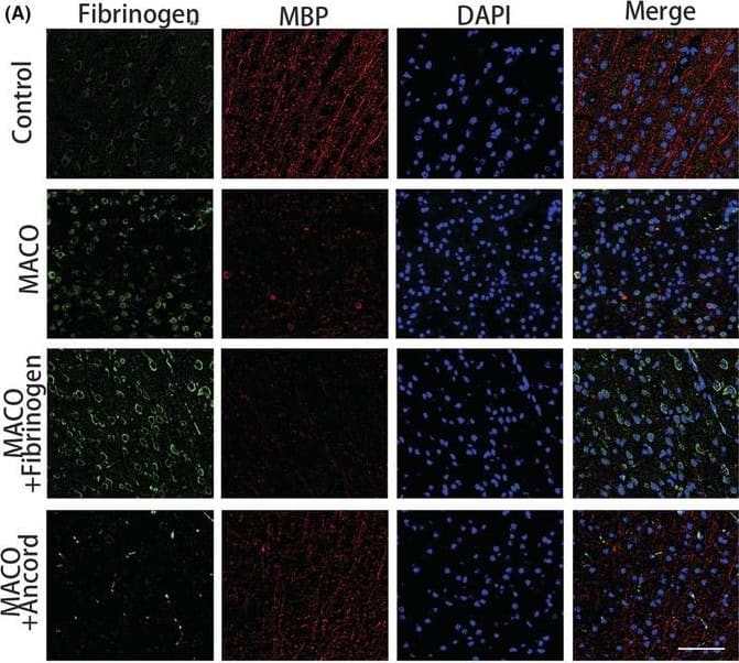 Fibrinogen Antibody