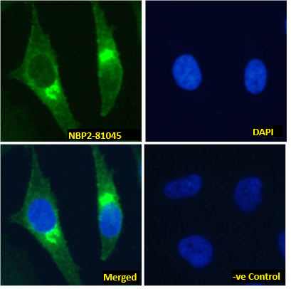 beta 2-Microglobulin Antibody (BBM.1) - Chimeric - Azide and BSA Free
