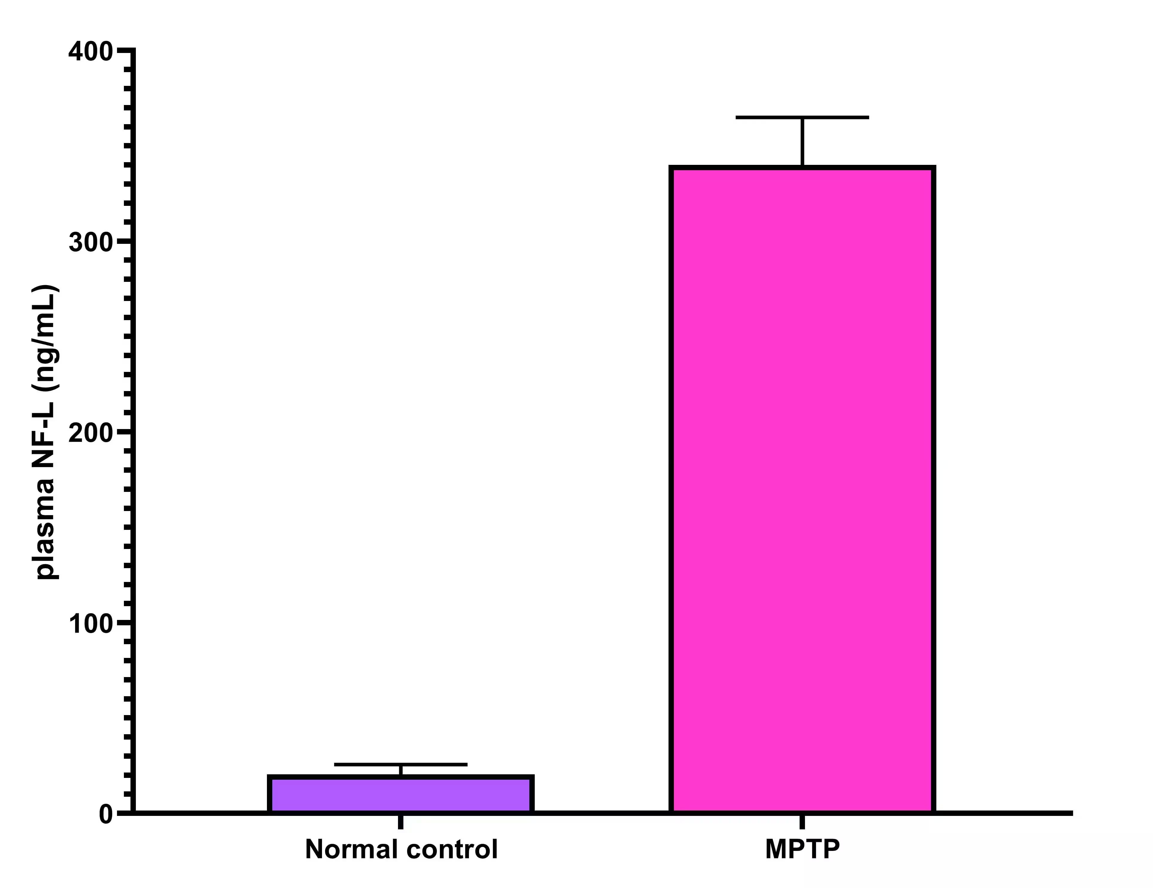 Rat NF-L ELISA Kit (Colorimetric)