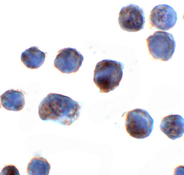 AKAIN1 Antibody - BSA Free