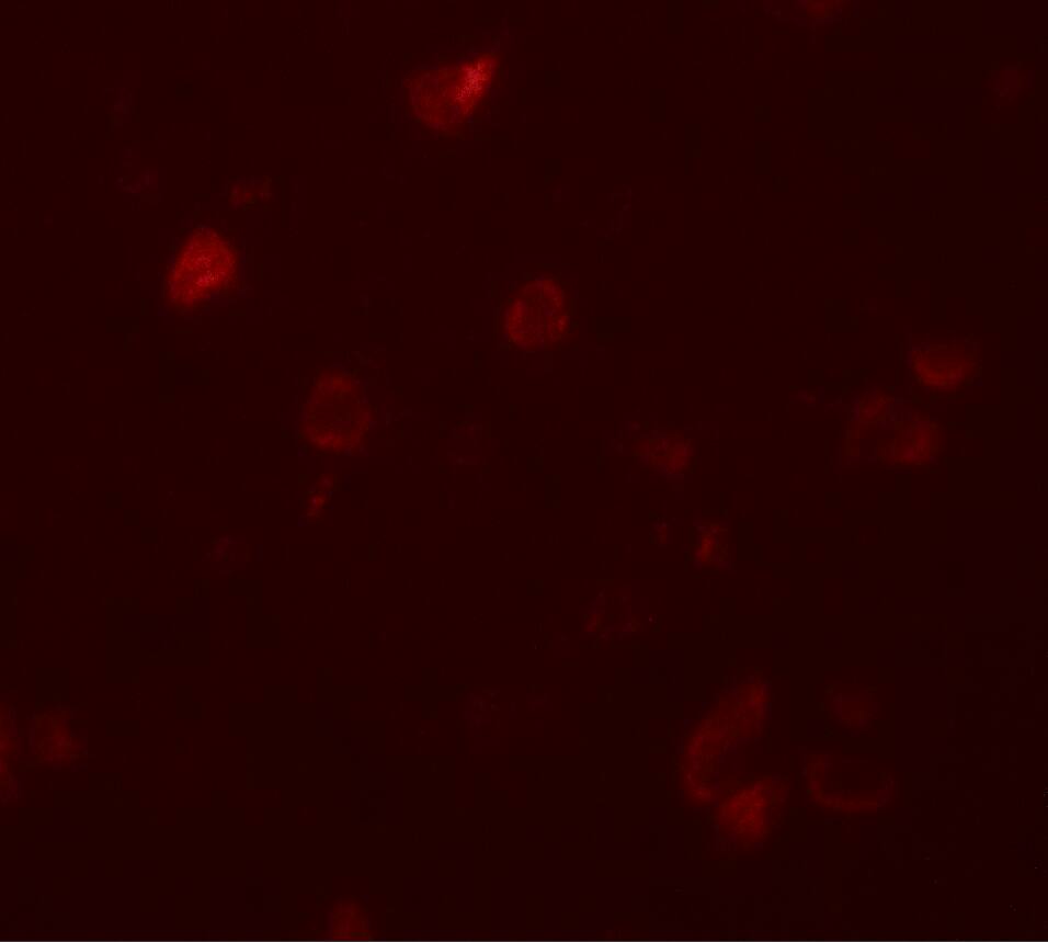 CCDC22 Antibody - BSA Free
