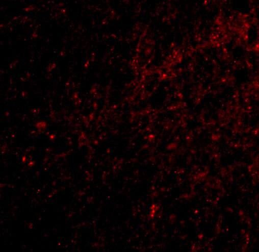 DLGAP3 Antibody - BSA Free