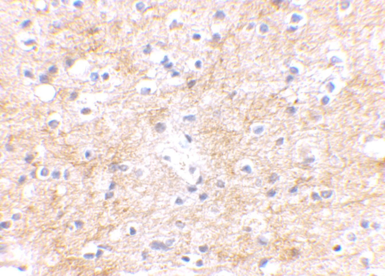 DLGAP3 Antibody - BSA Free