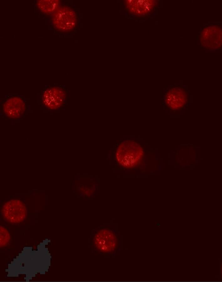 GBP6 Antibody - BSA Free