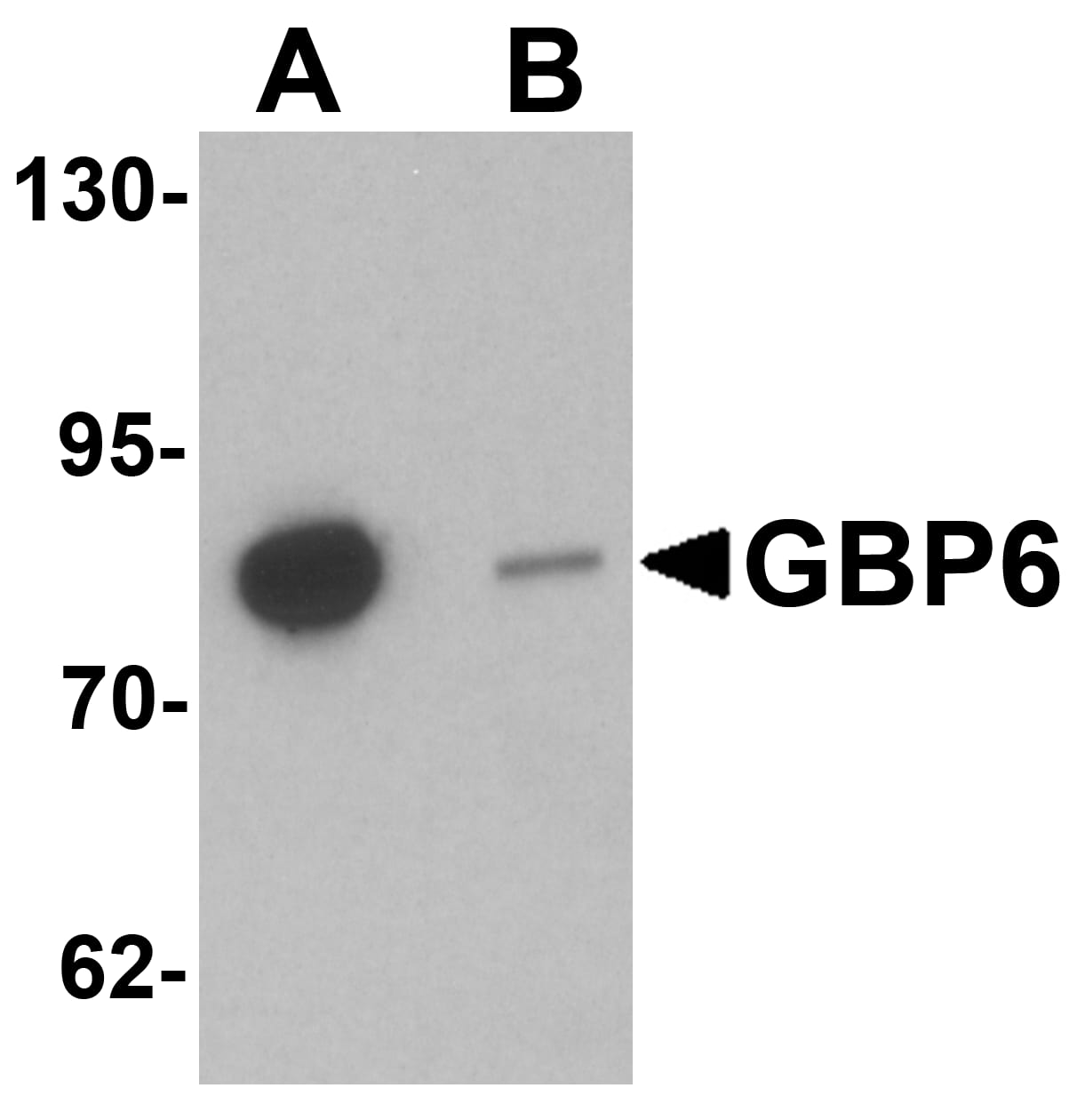 GBP6 Antibody - BSA Free