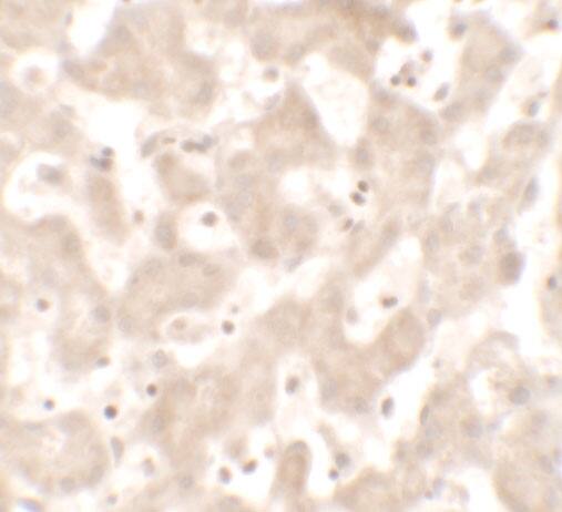 KHDC1 Antibody - BSA Free