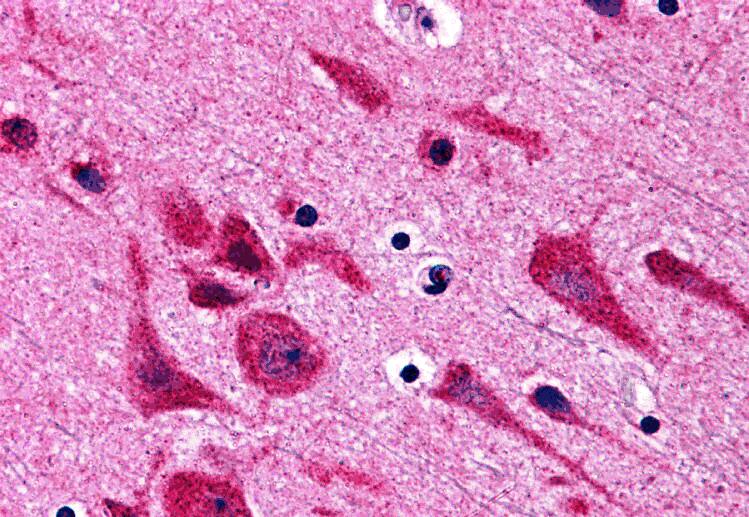 TAB2 Antibody - BSA Free