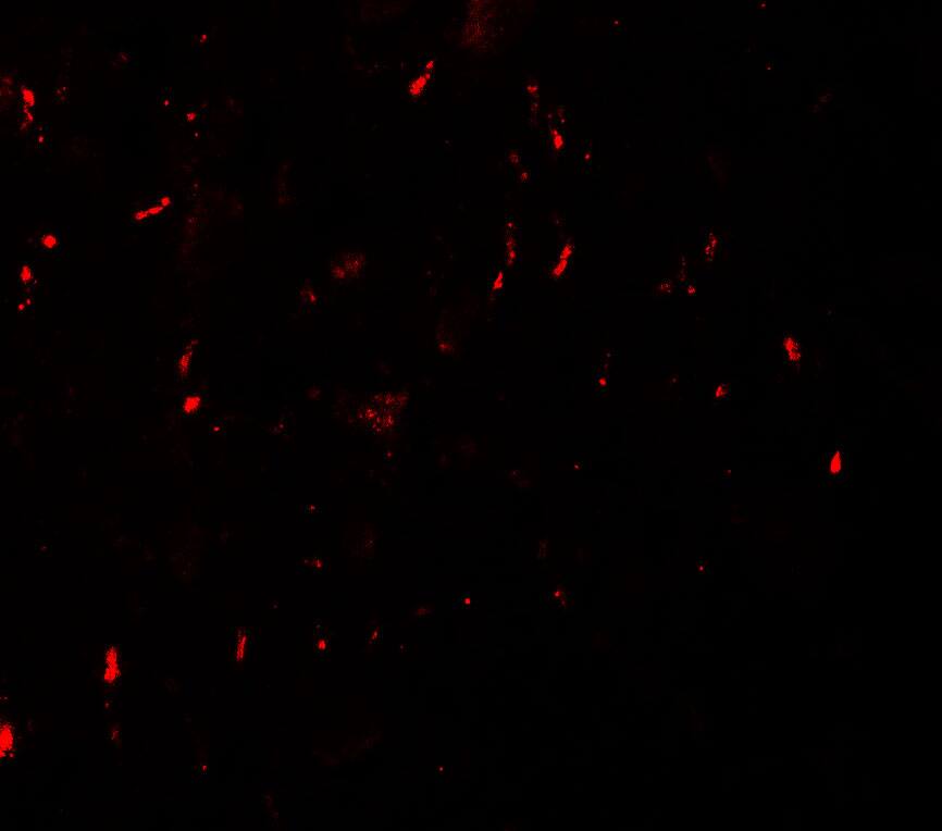 MYT1L Antibody - BSA Free