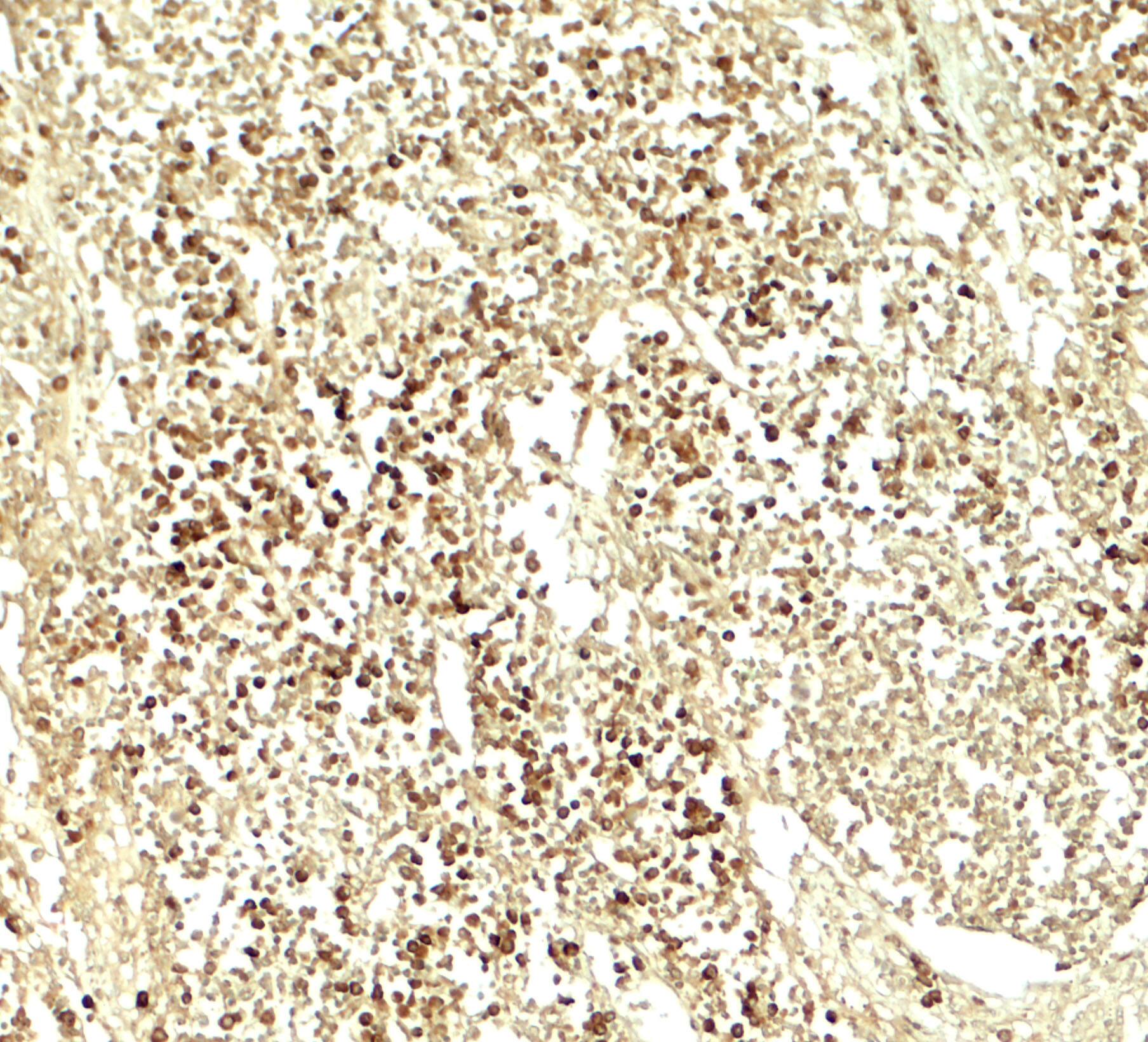 E2F3 Antibody - BSA Free