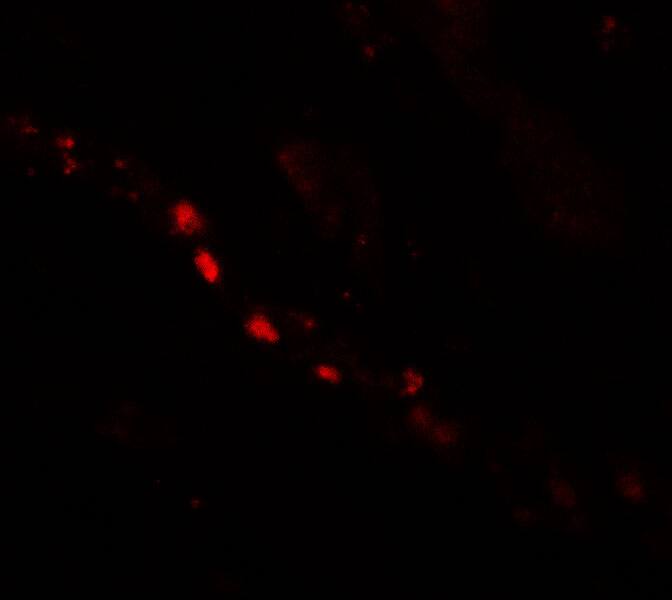 Patched Domain Containing 2 Antibody - BSA Free