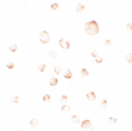 PHLPP Antibody - BSA Free