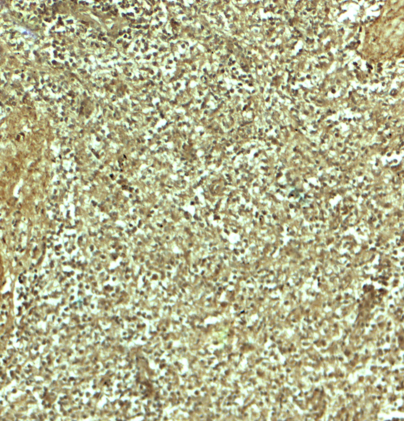 ADRM1 Antibody - BSA Free