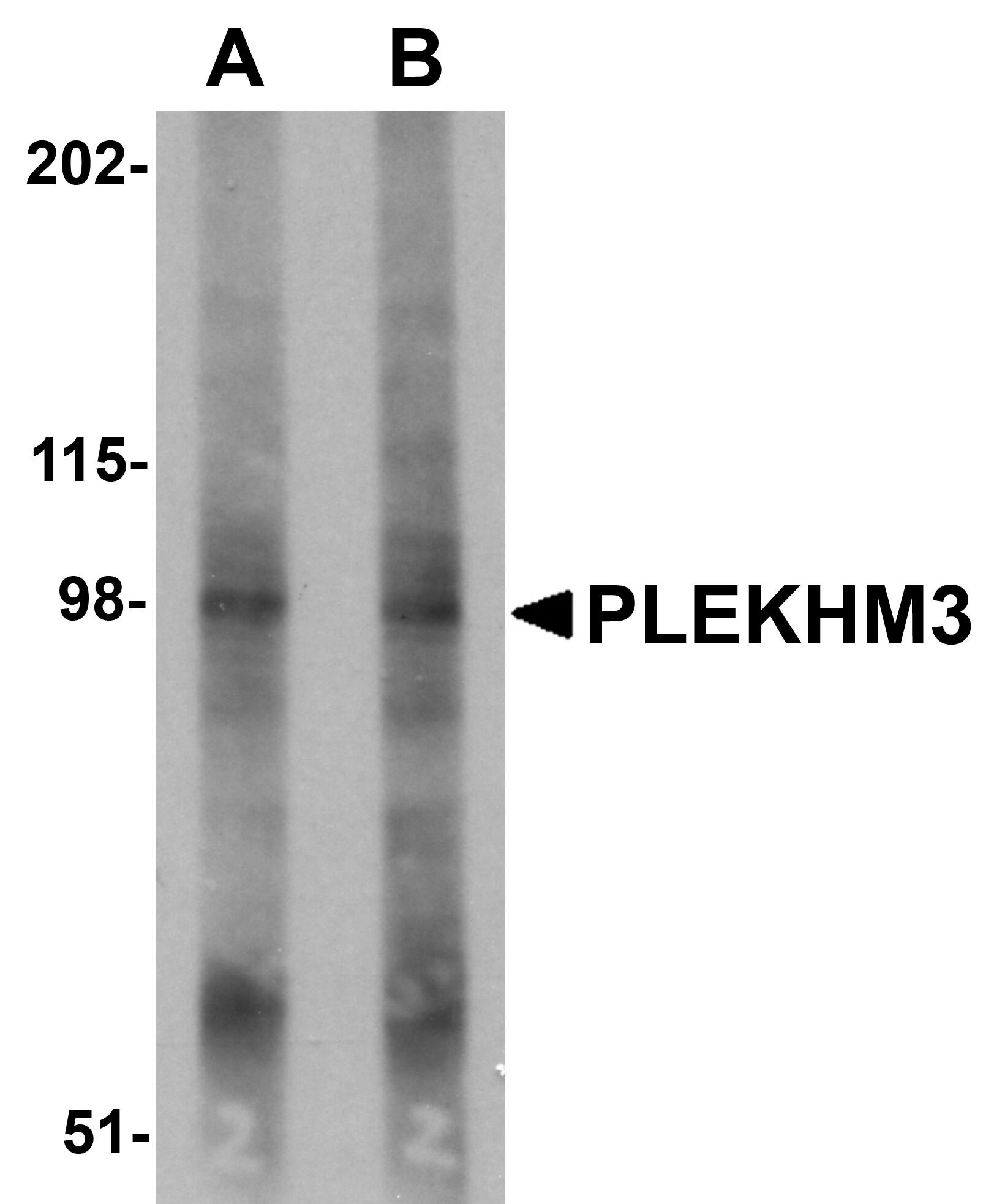 PLEKHM3 Antibody - BSA Free