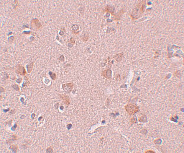 PLEKHM3 Antibody - BSA Free
