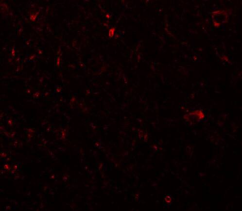 PLEKHM3 Antibody - BSA Free