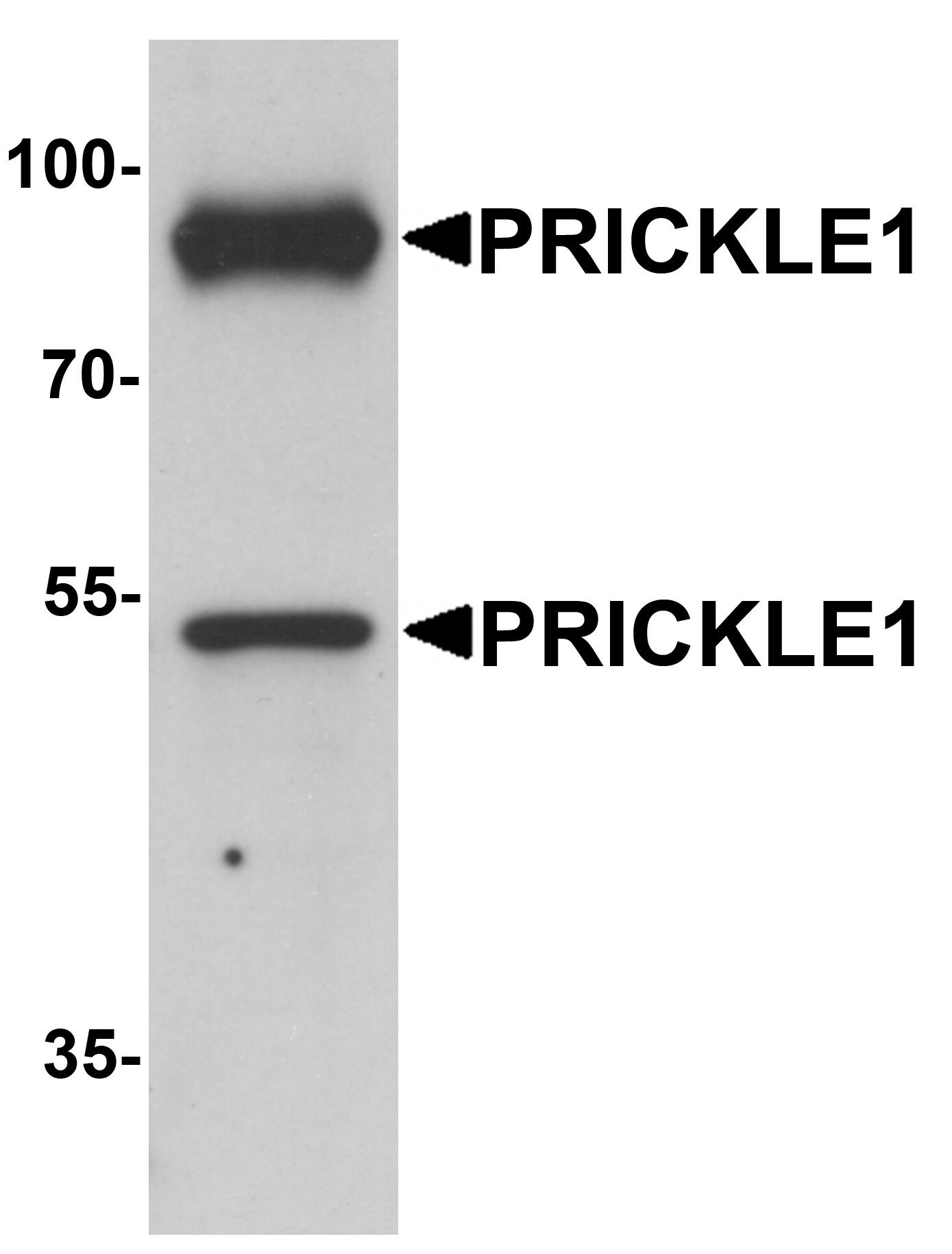 PRICKLE1 Antibody - BSA Free