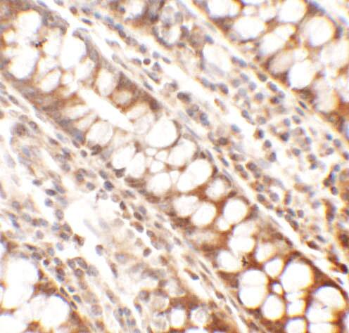 PPHLN1 Antibody - BSA Free