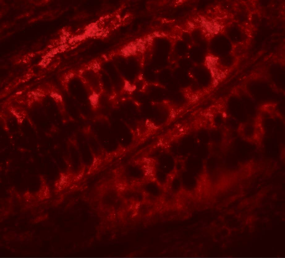 PPHLN1 Antibody - BSA Free