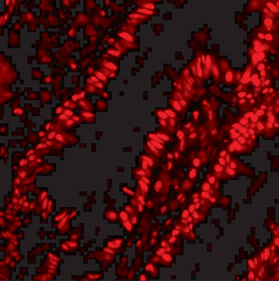 ANP32A Antibody - BSA Free