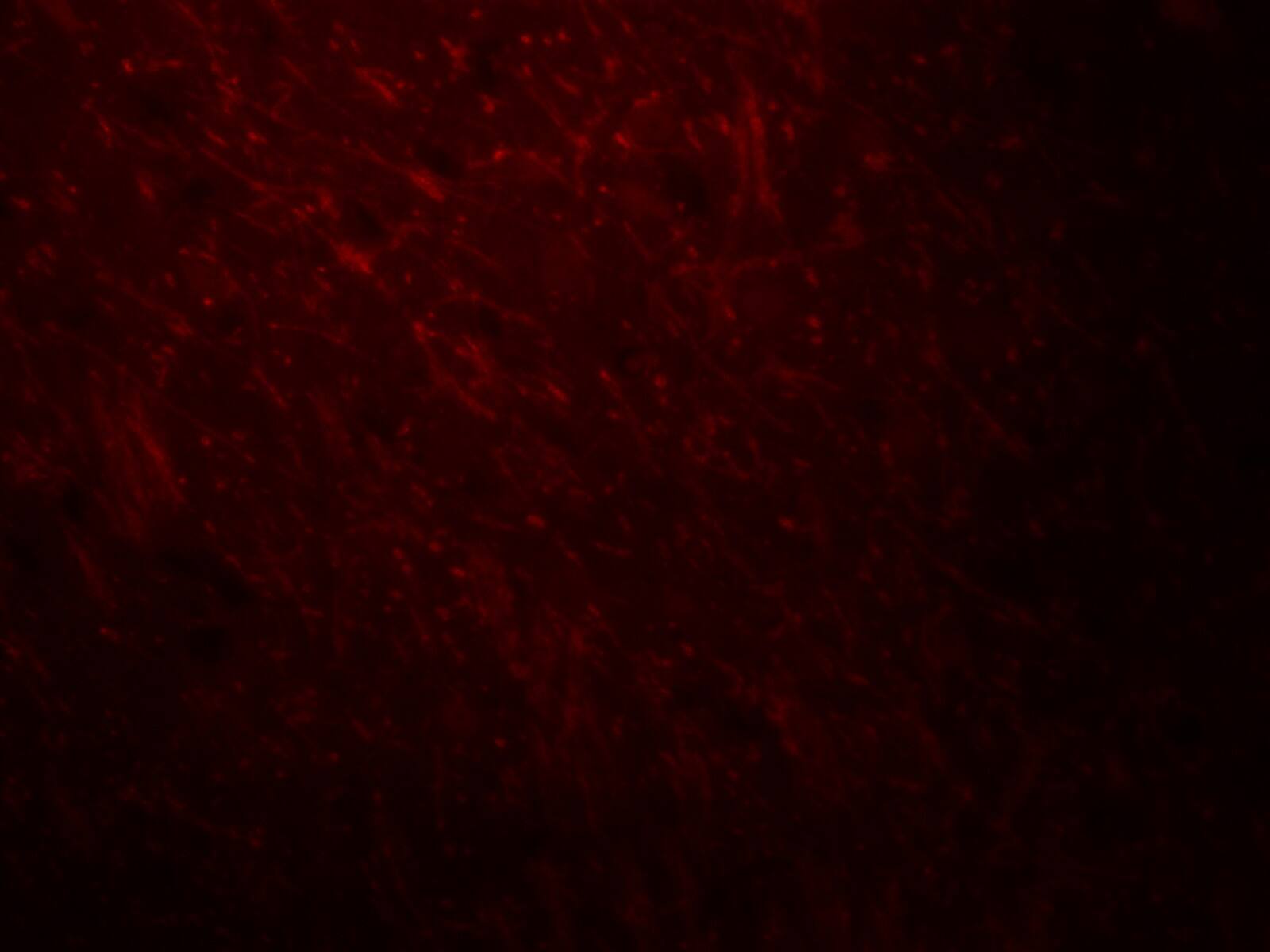 ARID1A Antibody - BSA Free