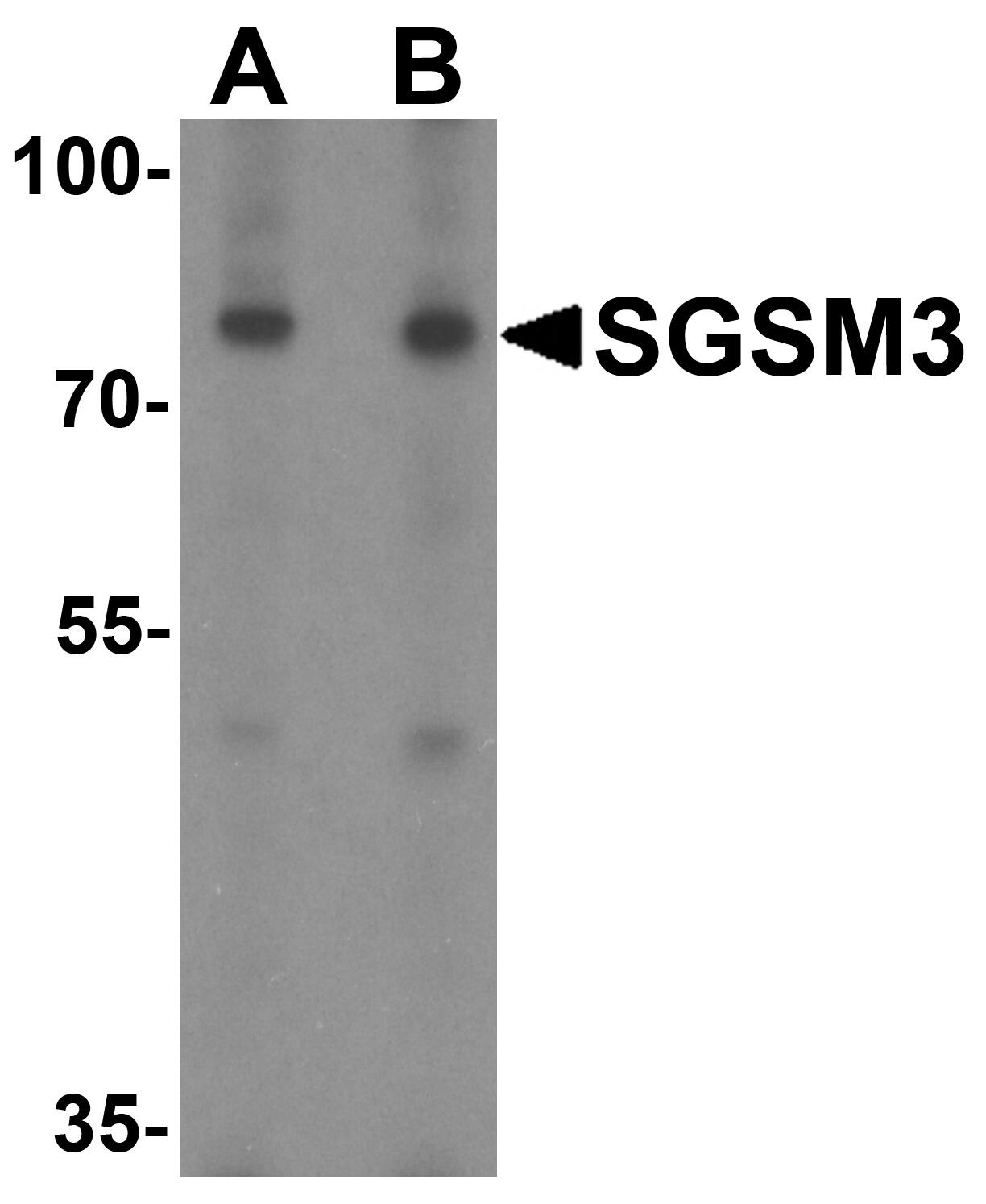 SGSM3 Antibody - BSA Free