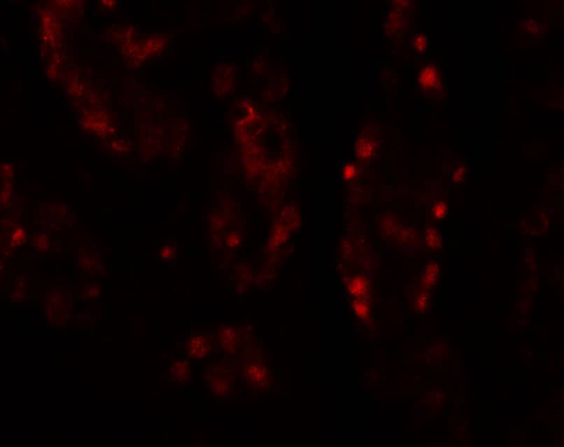 DISP1 Antibody - BSA Free
